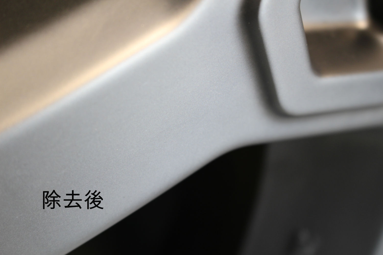 除去後-4